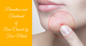 Read more about the article Acne Caused By Face Mask: Effective Prevention and Treatment (2021)